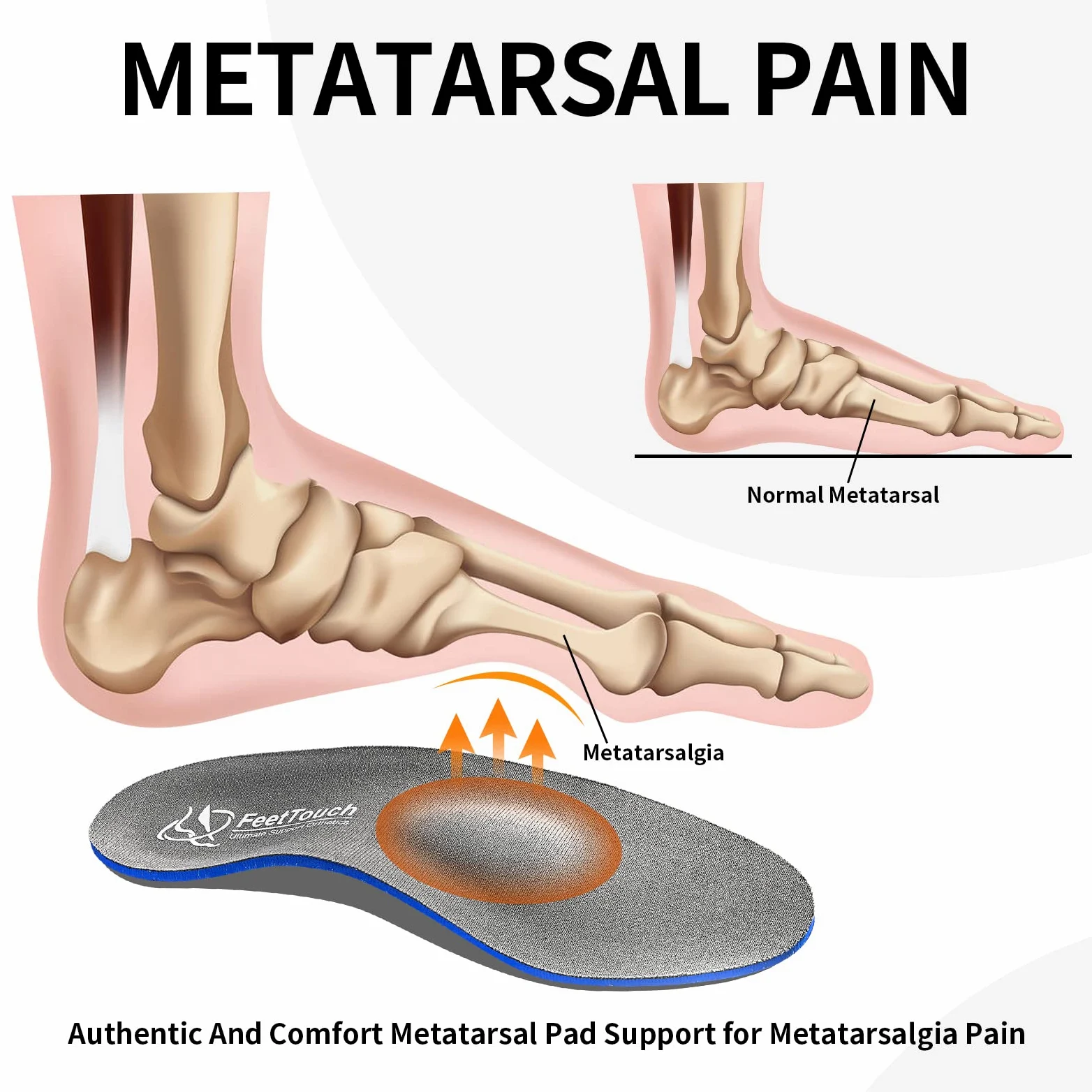 Ortesis de soporte de arco fuerte para neuroma de metatarsalgia Morton, inserto de alivio del dolor de bola de pie, fascitis plantar, pies planos con cojín de talón Poron, Gris,